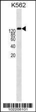 Anti-P-Glycoprotein Rabbit Polyclonal Antibody (AP (Alkaline Phosphatase))