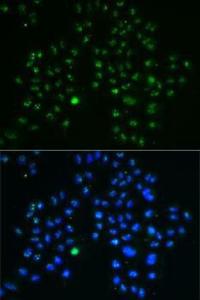 Immunofluorescence analysis of MCF7 cells using Anti-Nucleostemin Antibody (A9877). DAPI was used to stain the cell nuclei (blue)