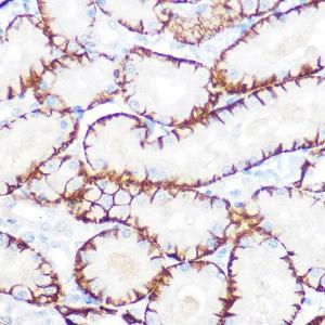 Immunohistochemistry analysis of paraffin-embedded rat kidney using Anti-NDRG1 Antibody [ARC0887] (A306340) at a dilution of 1:100 (40X lens). Perform microwave antigen retrieval with 10 mM PBS buffer pH 7.2 before commencing with IHC staining protocol