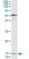 Anti-PTH Antibody Pair