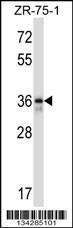 Anti-FETUB Rabbit Polyclonal Antibody (HRP (Horseradish Peroxidase))