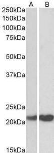 Anti-PEBP1 Antibody (A83828) (0.01µg/ml) staining of Human Cerebellum (A) and Mouse Testes (B) lysate (35µg protein in RIPA buffer). Primary incubation was 1 hour. Detected by chemiluminescence.