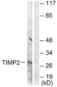 Anti-TIMP2 antibody