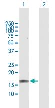 Anti-GRIN2C Rabbit Polyclonal Antibody