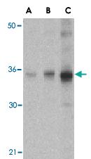 Anti-SOCS1 Rabbit Polyclonal Antibody