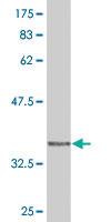 Anti-WAS Mouse Monoclonal Antibody [clone: 3H5]