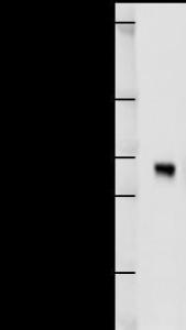 Anti-ABCA7 Rat Monoclonal Antibody [clone: 7A1-144]