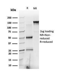 SDS-PAGE analysis of Anti-PRMT6 Antibody [PCRP-PRMT6-2C9] under non-reduced and reduced conditions; showing intact IgG and intact heavy and light chains, respectively. SDS-PAGE analysis confirms the integrity and purity of the Antibody