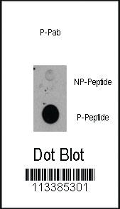 Anti-RPS6KA1 Rabbit Polyclonal Antibody