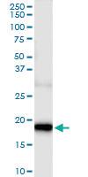 Anti-GRIN2C Rabbit Polyclonal Antibody