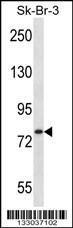 Anti-ARHGAP24 Rabbit Polyclonal Antibody (FITC (Fluorescein Isothiocyanate))