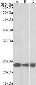 Anti-PEBP1 Antibody (A83828) (0.01µg/ml) staining of NIH-3T3 (A) , HEK293 (B) and HepG2 (C) lysate (35µg protein in RIPA buffer). Primary incubation was 1 hour. Detected by chemiluminescence.