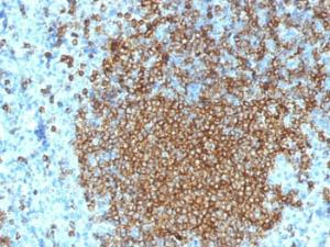 Immunohistochemical analysis of formalin-fixed, paraffin-embedded human spleen using Anti-CD45RA Antibody [K4B5]