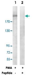 Anti-ITGB4 Rabbit Polyclonal Antibody