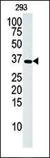 Anti-DGUOK Rabbit Polyclonal Antibody (FITC (Fluorescein))