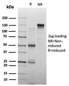 Anti-ZHX3 antibody