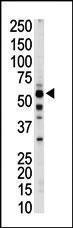 Anti-PKLR Rabbit Polyclonal Antibody (Biotin)