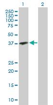 Anti-OGN Rabbit Polyclonal Antibody