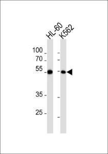 Anti-MEF2C Rabbit Polyclonal Antibody (FITC (Fluorescein))