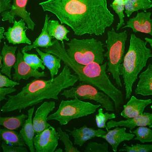 Immunoflourescent analysis of HeLa cells stained with Anti-DJ1 Antibody [4H4] (A85343) at a dilution of 1:1,000, in green, and co-stained with Anti-Lamin A + C Antibody (A85443), at a dilution of 1:5,000, in red