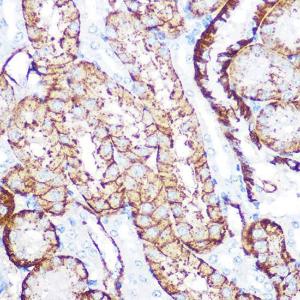 Immunohistochemistry analysis of paraffin-embedded mouse kidney using Anti-NDRG1 Antibody [ARC0887] (A306340) at a dilution of 1:100 (40X lens). Perform microwave antigen retrieval with 10 mM PBS buffer pH 7.2 before commencing with IHC staining protocol