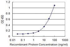 Anti-OGN Mouse Monoclonal Antibody [clone: 2G4]