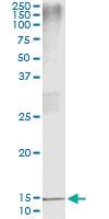 Anti-PTH Antibody Pair