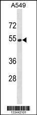 Anti-HERPUD2 Rabbit Polyclonal Antibody (APC (Allophycocyanin))