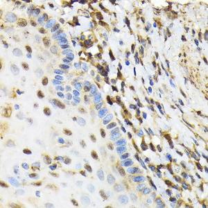 Immunohistochemistry analysis of paraffin-embedded human esophageal using Anti-NRBF2 Antibody (A9878) at a dilution of 1:100 (40x lens). Perform microwave antigen retrieval with 10 mM Tris/EDTA buffer pH 9.0 before commencing with IHC staining protocol