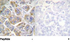 Anti-ITGB4 Rabbit Polyclonal Antibody