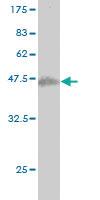 Anti-SENP6 Mouse Monoclonal Antibody [clone: 4B7]