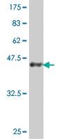 Anti-ARPC5 Mouse Polyclonal Antibody