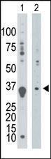 Anti-DGUOK Rabbit Polyclonal Antibody (APC (Allophycocyanin))