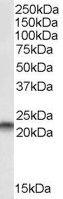 Anti-PEBP1 Antibody (A83828) staining (0.01µg/ml) of A549 lysate (RIPA buffer, 35µg total protein per lane). Primary incubated for 1 hour. Detected by chemiluminescence.