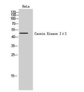 Antibody anti-CKI-gamma2 100 µg