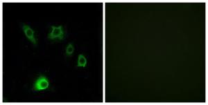 Immunofluorescence analysis of HUVEC cells using Anti-FGF18 Antibody. The right hand panel represents a negative control, where the antibody was pre-incubated with the immunising peptide