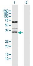 Anti-OLR1 Rabbit Polyclonal Antibody