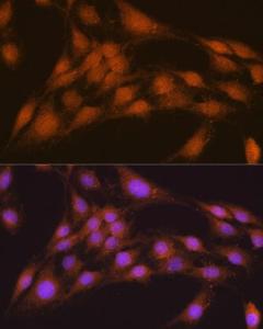 Immunofluorescence analysis of C6 cells using Anti-NRBF2 Antibody (A9878) at a dilution of 1:100. DAPI was used to stain the cell nuclei (blue)