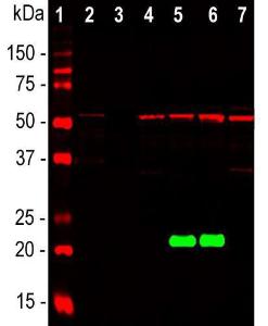 Western blot analysis of whole brain and cel