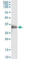 Anti-OLR1 Rabbit Polyclonal Antibody