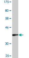 Anti-TMEFF1 Mouse Monoclonal Antibody [clone: 1B1]