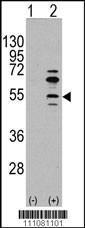 Anti-MEF2C Rabbit Polyclonal Antibody (APC (Allophycocyanin))