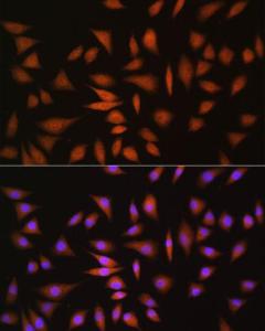 Immunofluorescence analysis of L929 cells using Anti-NRBF2 Antibody (A9878) at a dilution of 1:100. DAPI was used to stain the cell nuclei (blue)