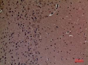 Immunohistochemical analysis of paraffin-embedded mouse brain using Anti-INPPL1 Antibody