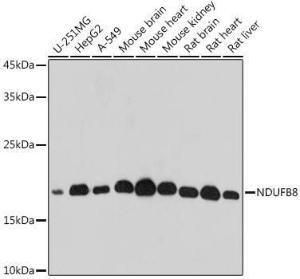 Western blot analysis of extracts of various cell lines, using Anti-NDUFB8 Antibody (A305426) at 1:500 dilution