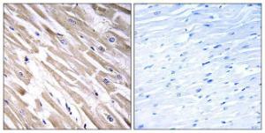 Immunohistochemical analysis of paraffin-embedded human heart tissue using Anti-FGF18 Antibody. The right hand panel represents a negative control, where the antibody was pre-incubated with the immunising peptide