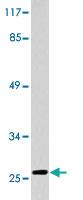 Anti-CD3E Rabbit Polyclonal Antibody