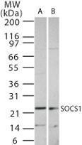 Anti-BRCA1 Mouse monoclonal antibody unconjugated [clone: RAY]