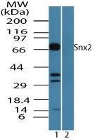 Anti-SNX2 Rabbit Polyclonal Antibody