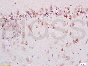 Anti-AMBRA1 Rabbit Polyclonal Antibody